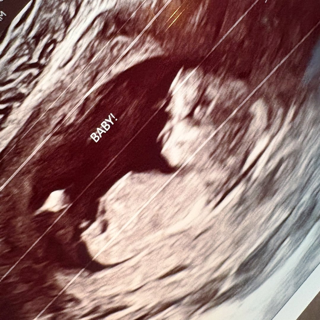 Photo shared by Jahmea for their Babylist baby registry.