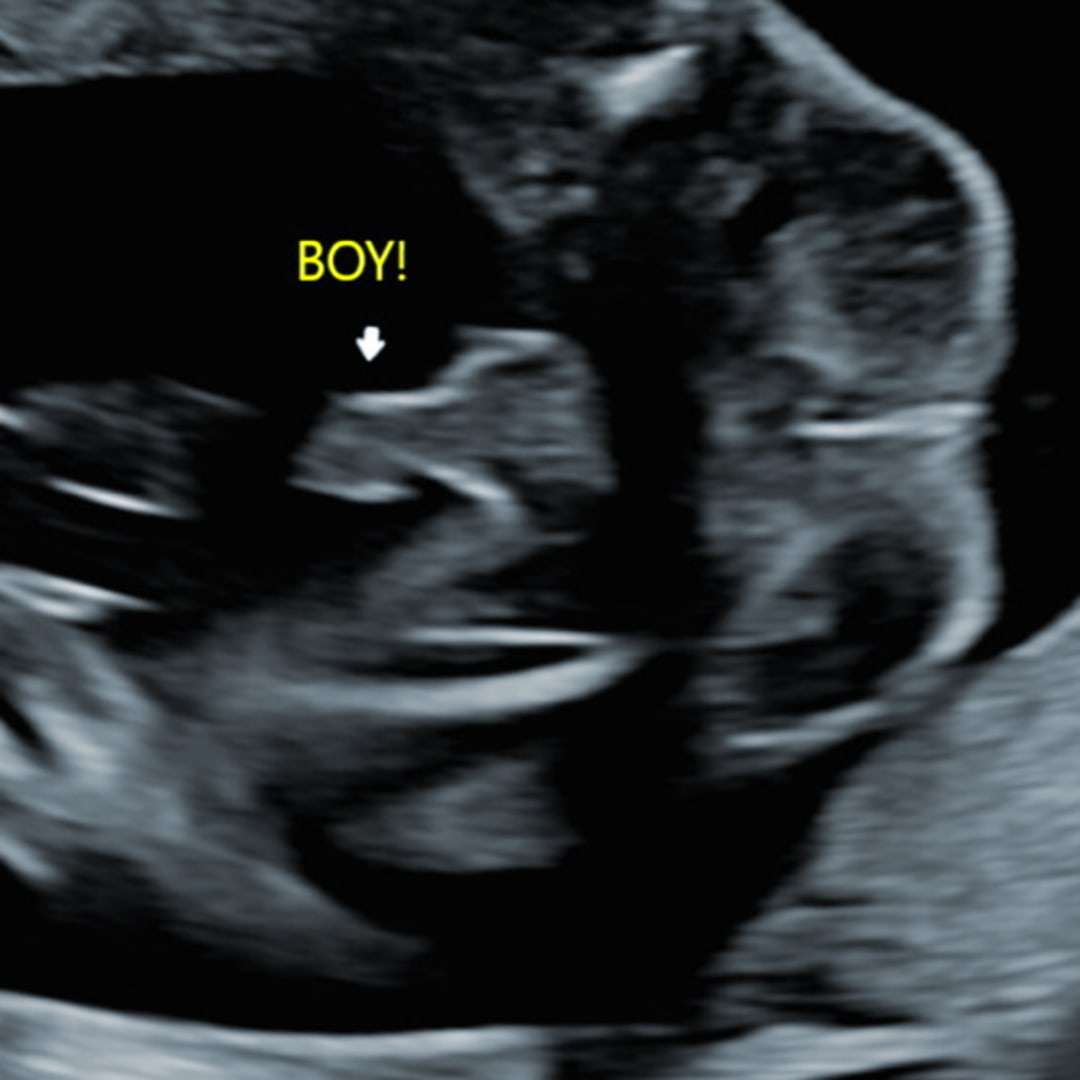 Photo shared by Molly for their Babylist baby registry.