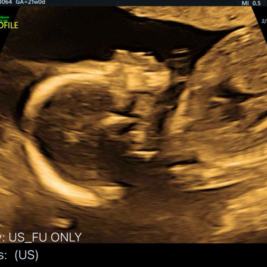 Photo shared by Brooklynne for their Babylist baby registry.