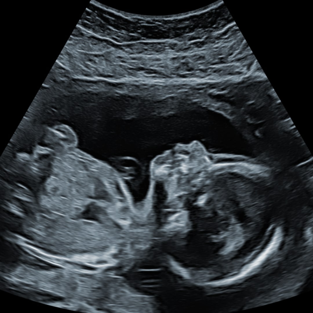 Photo shared by Ashley for their Babylist baby registry.