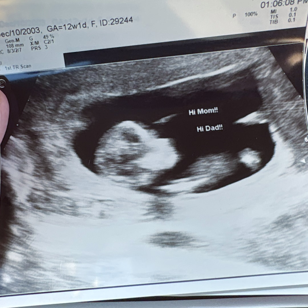 Photo shared by Hope for their Babylist baby registry.