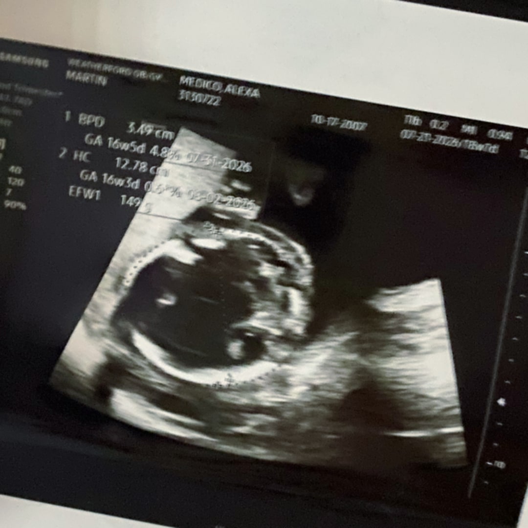 Photo shared by Alexa for their Babylist baby registry.