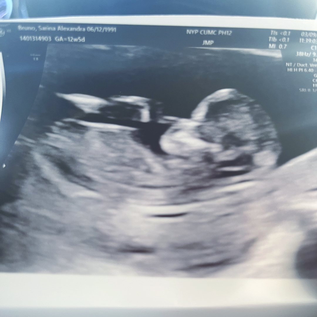 Photo shared by Sarina for their Babylist baby registry.