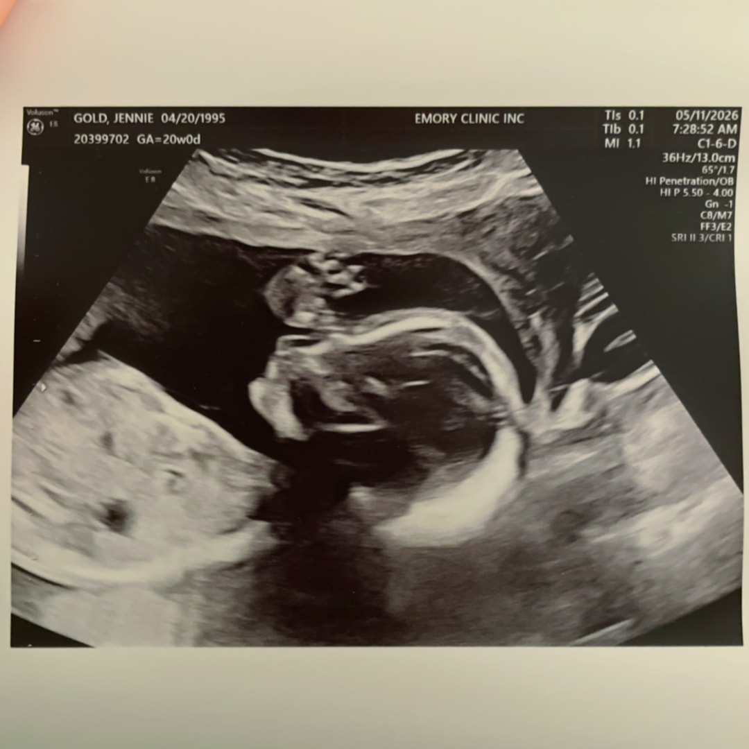 Photo shared by Jennie for their Babylist baby registry.