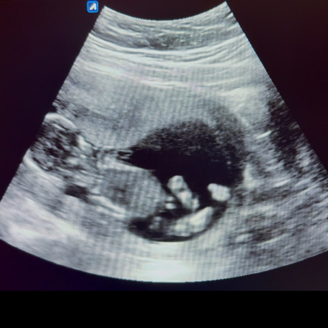 Photo shared by Kelsey for their Babylist baby registry.