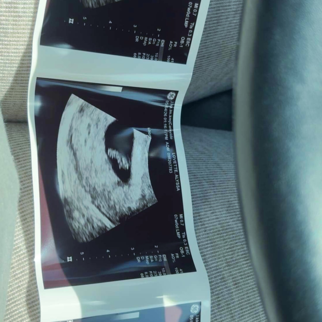 Photo shared by Alyssa for their Babylist baby registry.