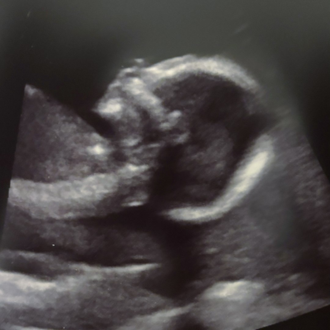 Photo shared by Olivia for their Babylist baby registry.