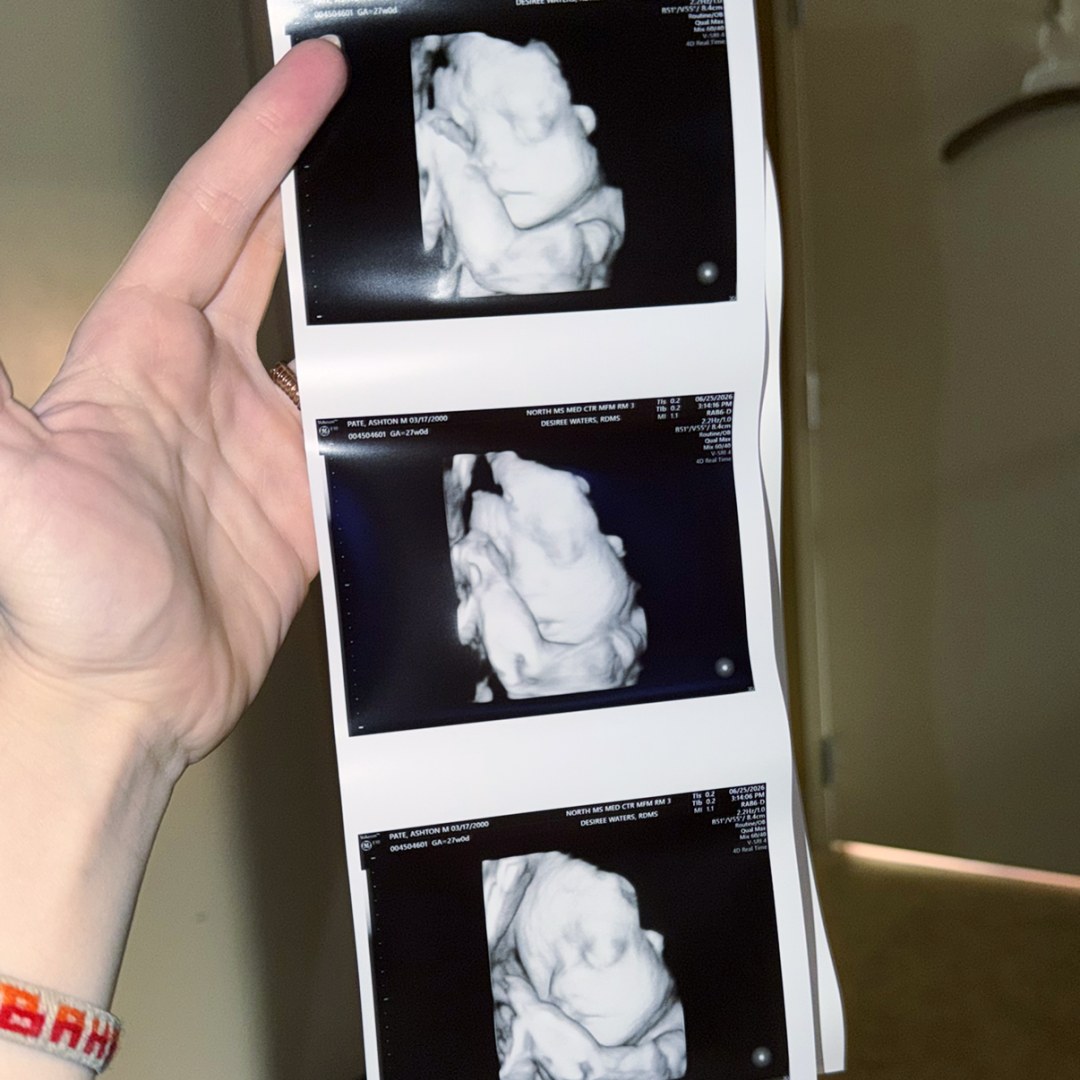 Photo shared by Mackenzie for their Babylist baby registry.