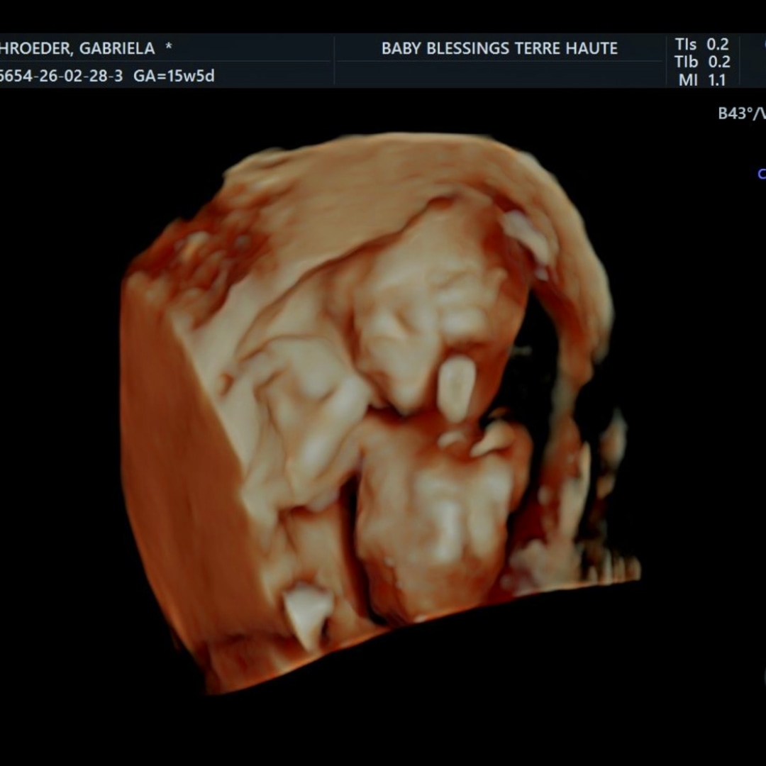 Photo shared by Gabriela for their Babylist baby registry.