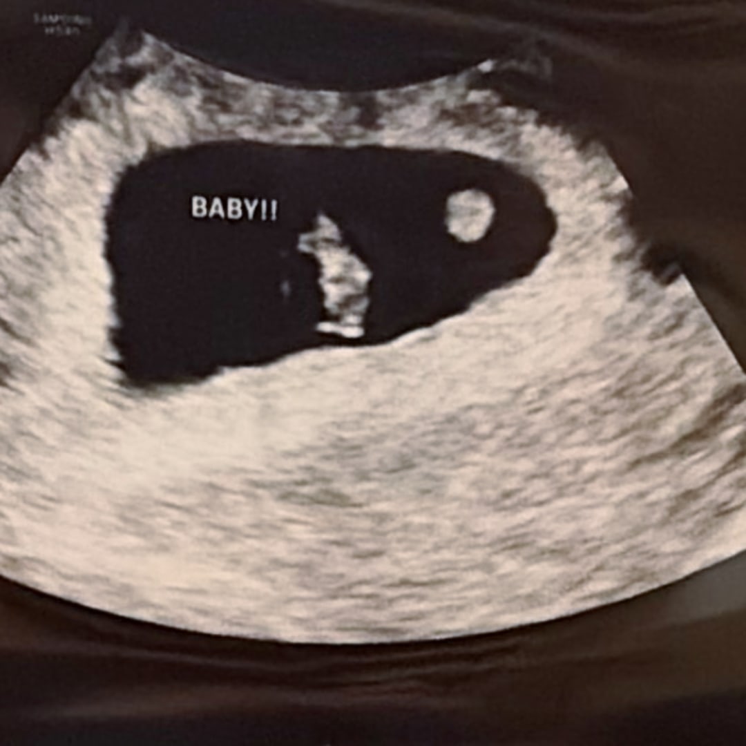 Photo shared by ViAnna for their Babylist baby registry.