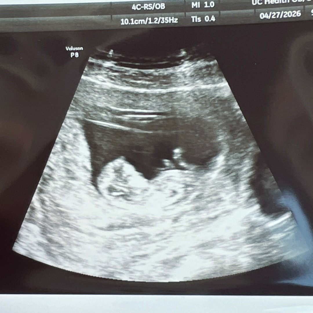 Photo shared by Madison for their Babylist baby registry.