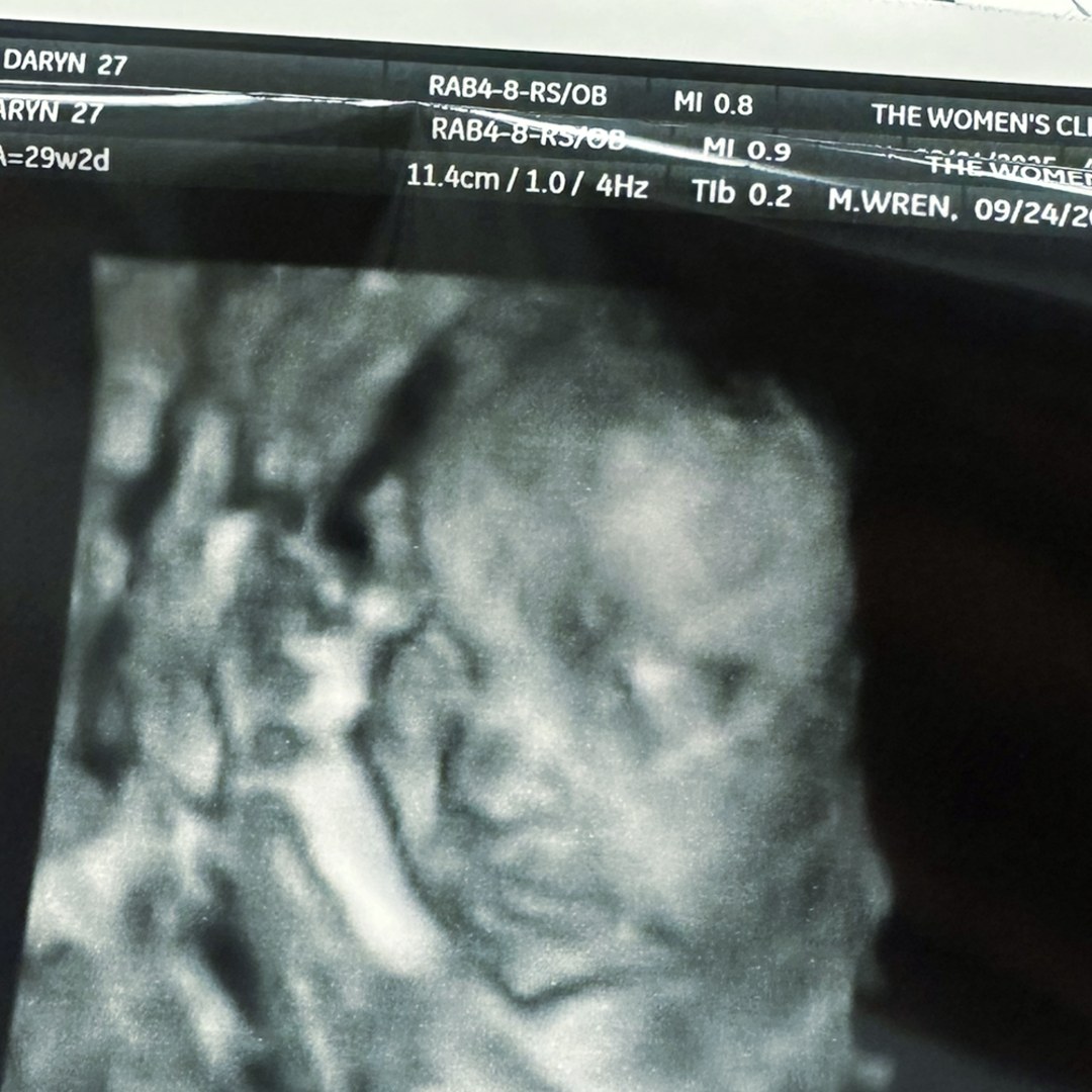 Photo shared by Daryn for their Babylist baby registry.