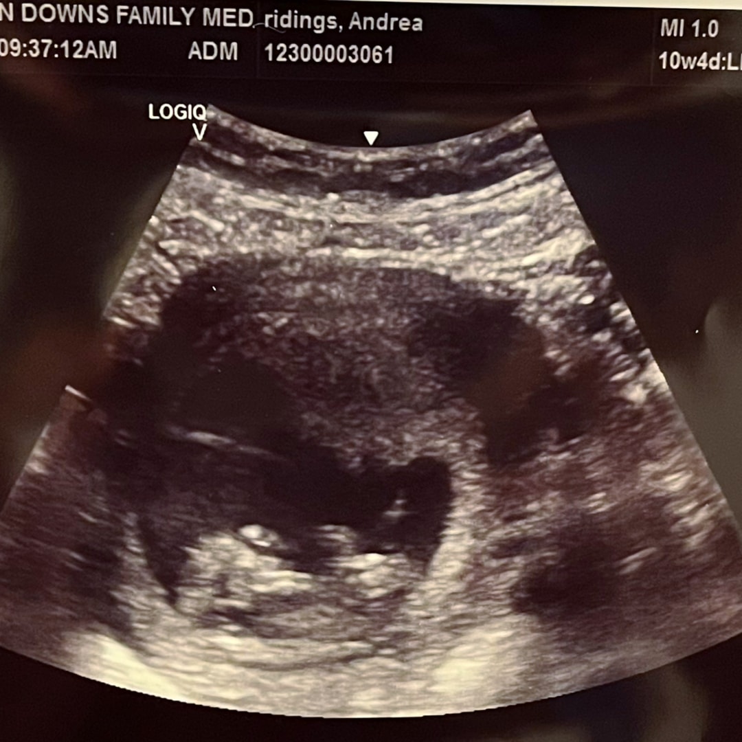 Photo shared by Andi for their Babylist baby registry.