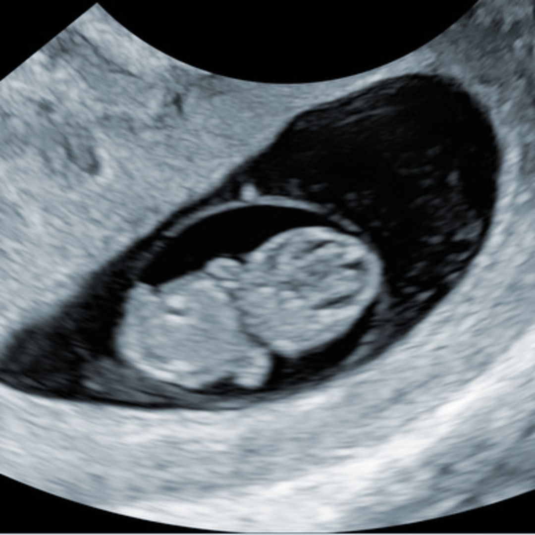 Photo shared by Carla for their Babylist baby registry.