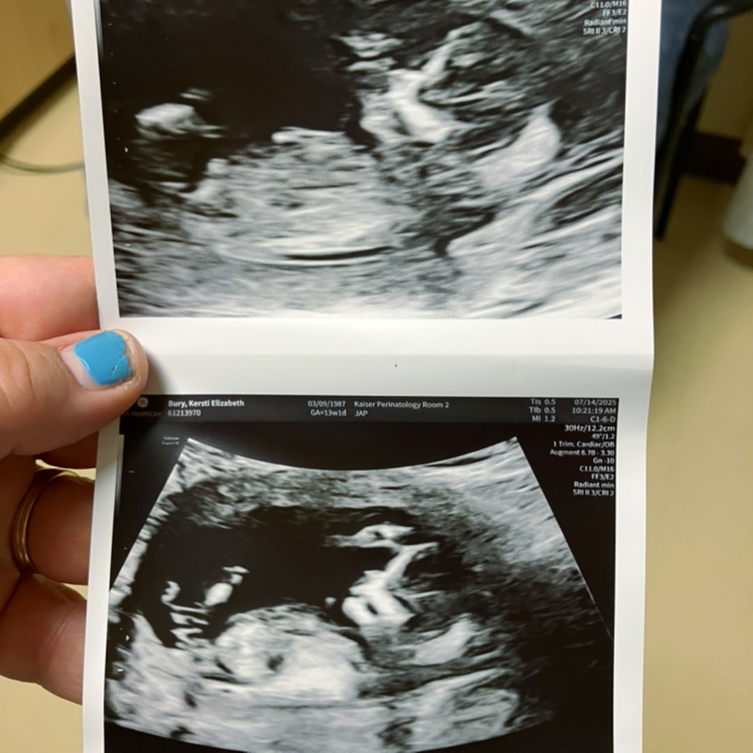 Photo shared by Kersti for their Babylist baby registry.