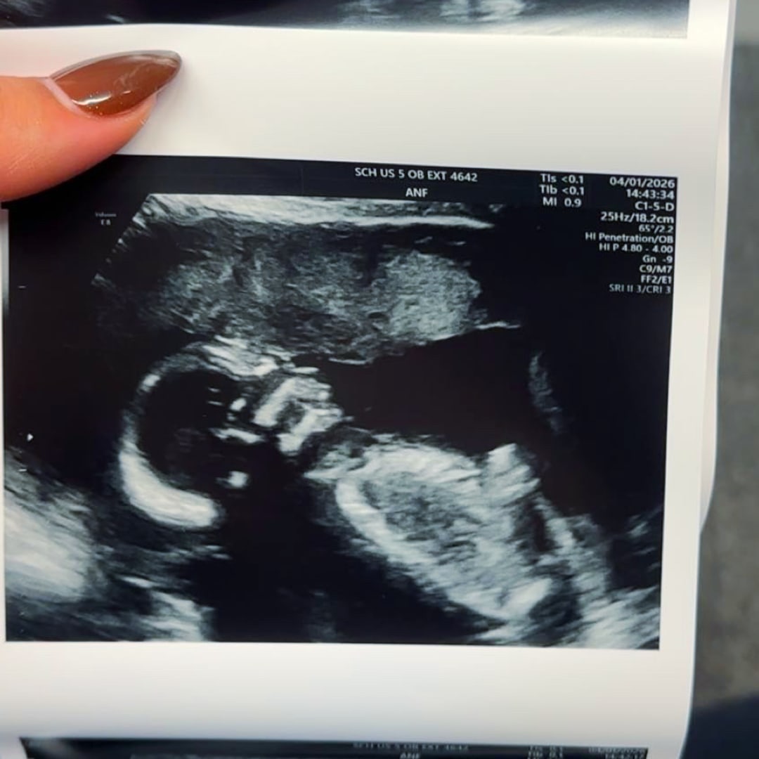 Photo shared by Sophia for their Babylist baby registry.