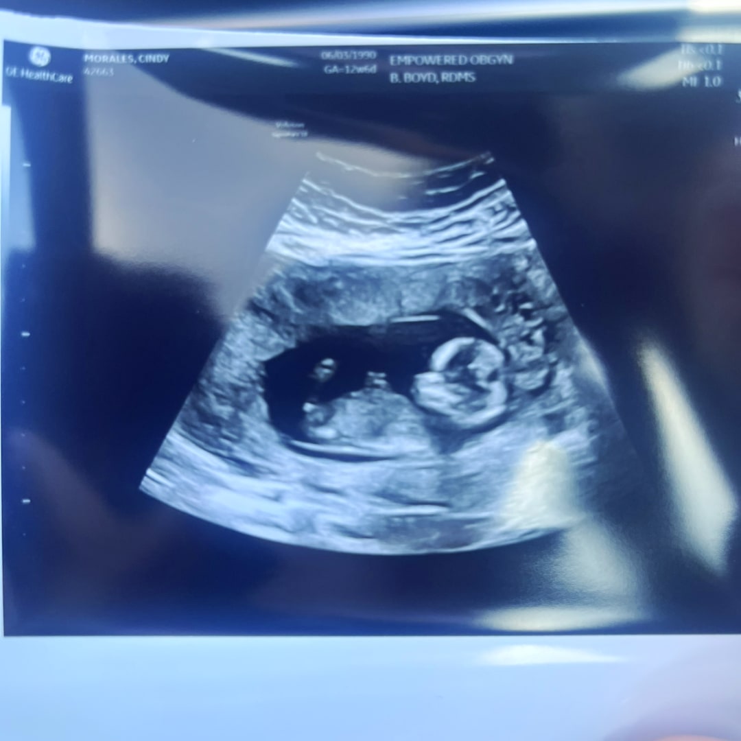 Photo shared by Cindy for their Babylist baby registry.