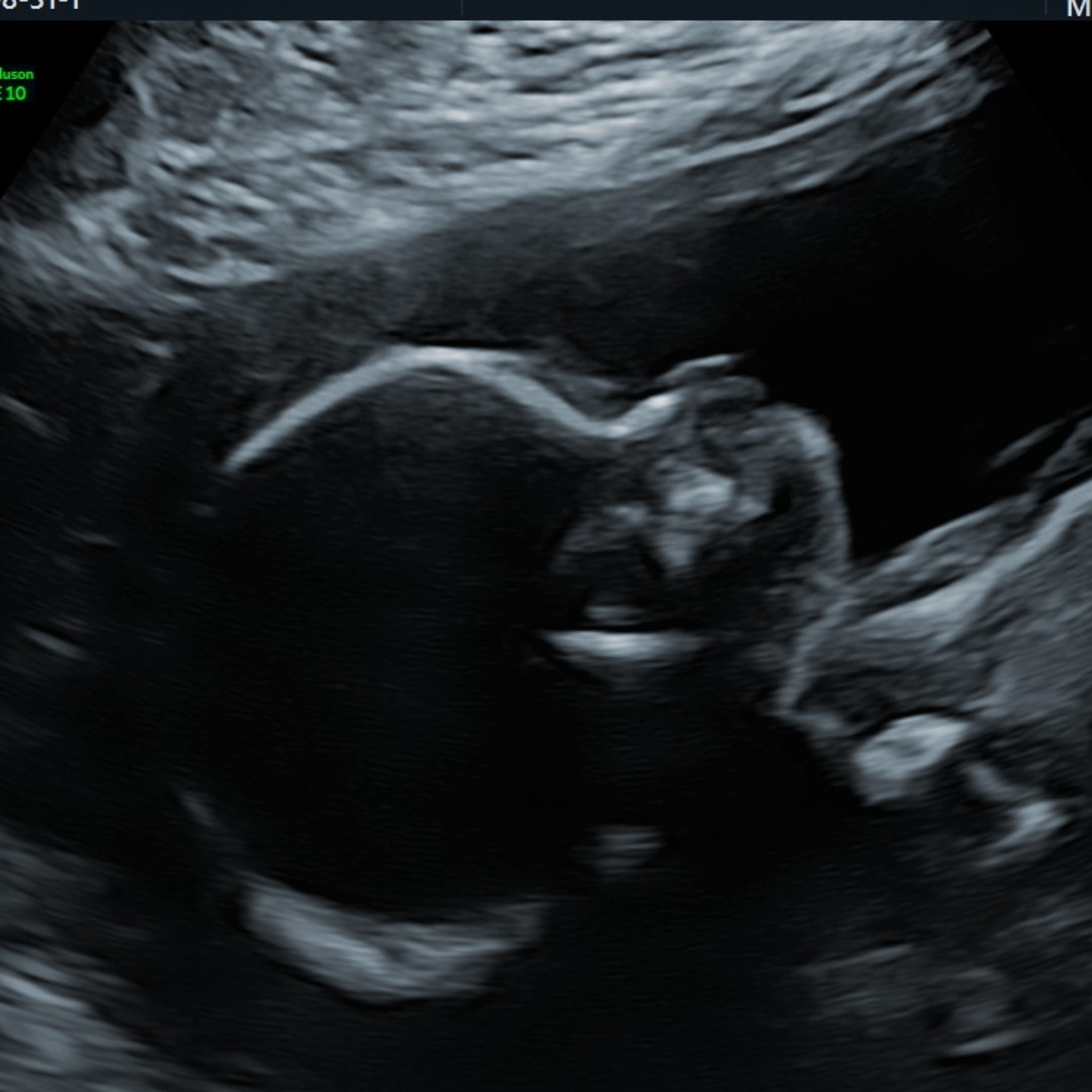 Photo shared by Sandra for their Babylist baby registry.