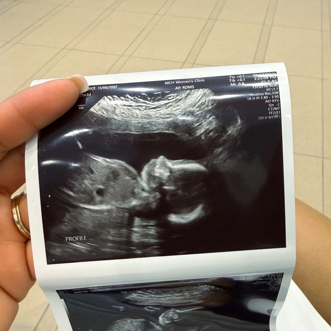 Photo shared by Berenice for their Babylist baby registry.