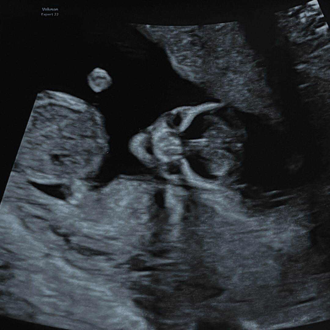 Photo shared by Stephanie for their Babylist baby registry.