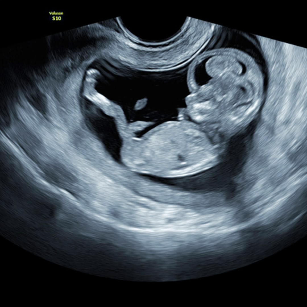Photo shared by Andrea for their Babylist baby registry.