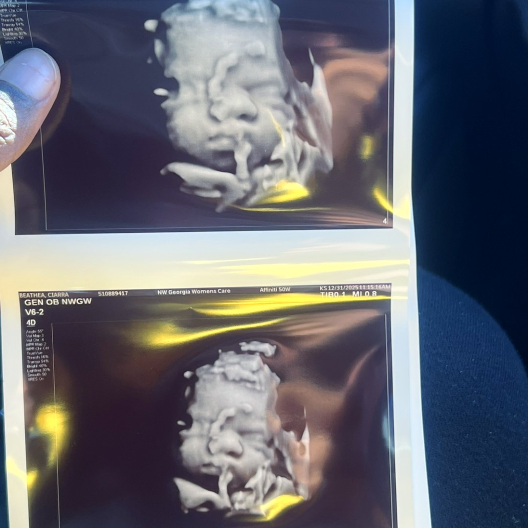 Photo shared by Ciarra for their Babylist baby registry.