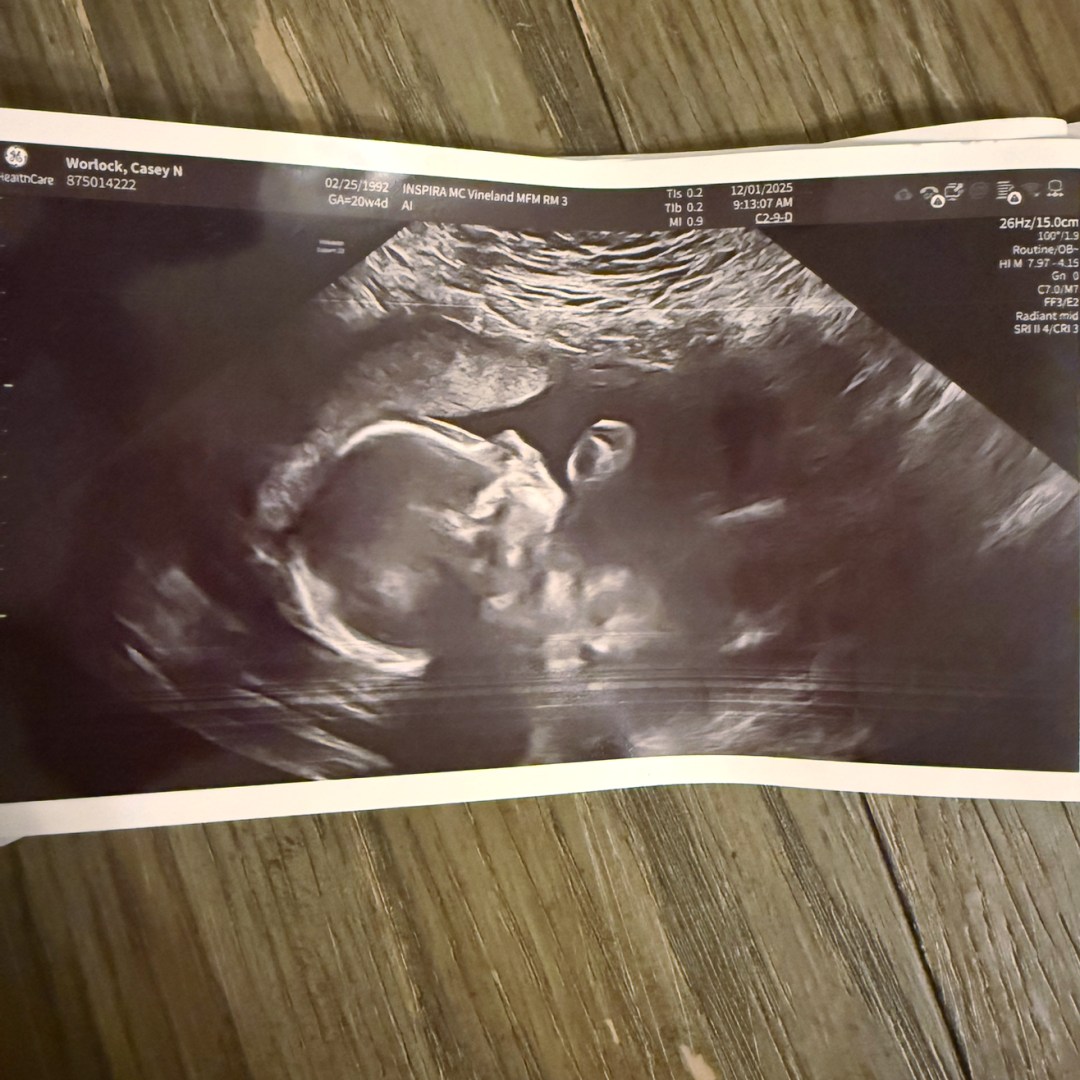 Photo shared by Casey for their Babylist baby registry.