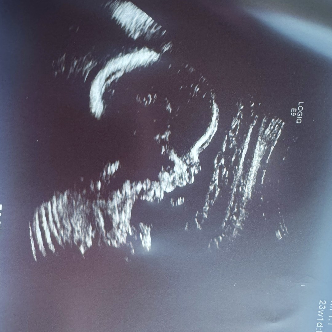 Photo shared by Asia for their Babylist baby registry.