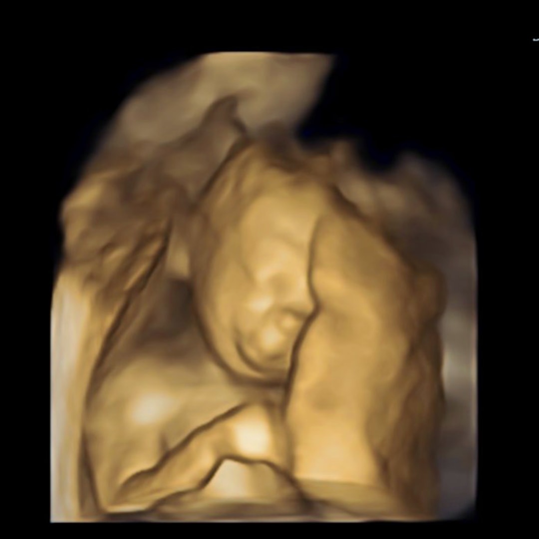 Photo shared by Yesenia for their Babylist baby registry.