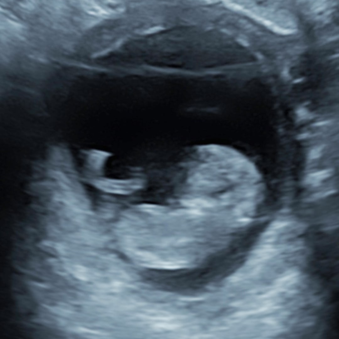 Photo shared by Holly for their Babylist baby registry.
