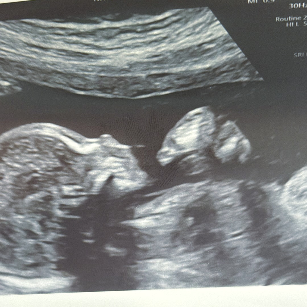 Photo shared by Denise for their Babylist baby registry.