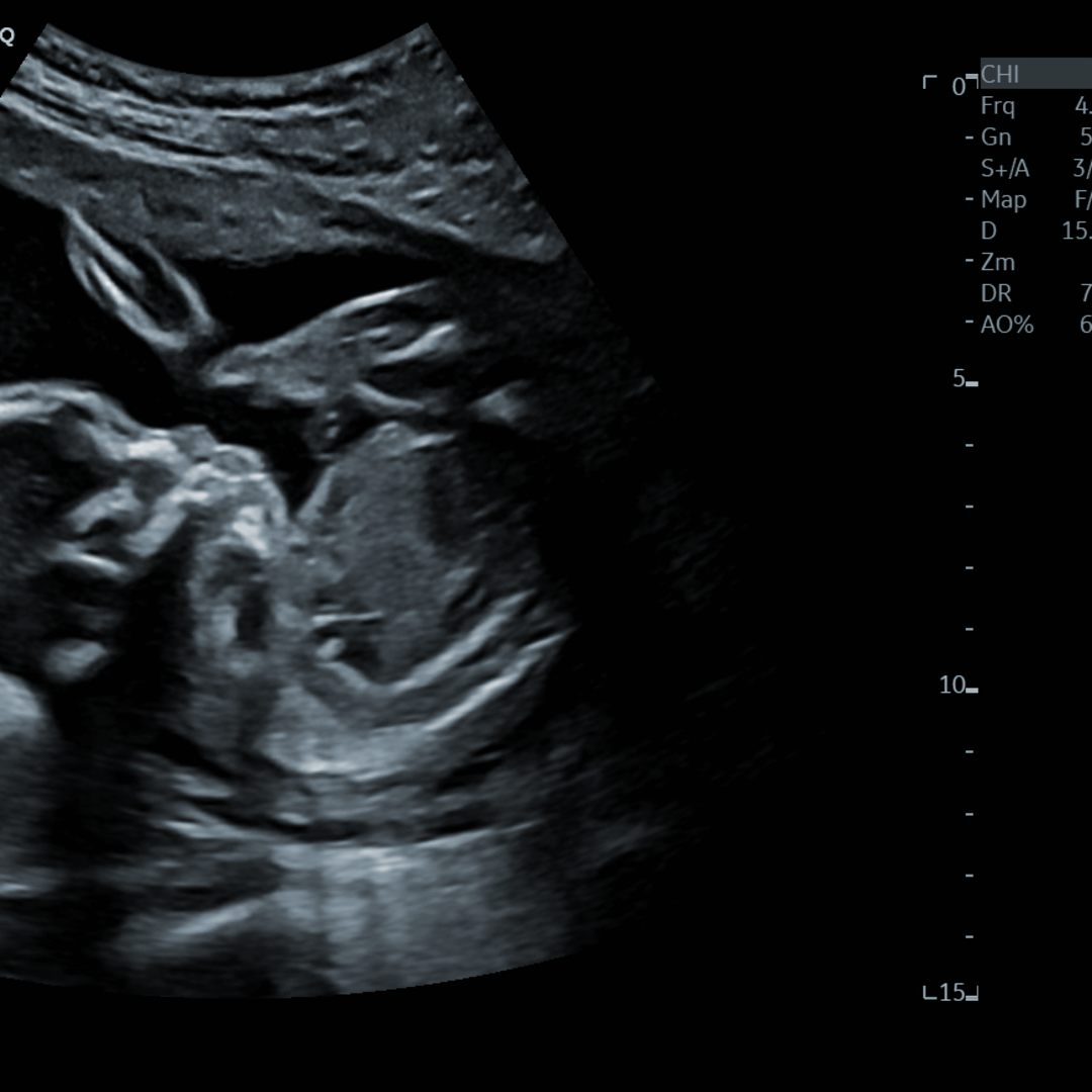 Photo shared by Aalena for their Babylist baby registry.