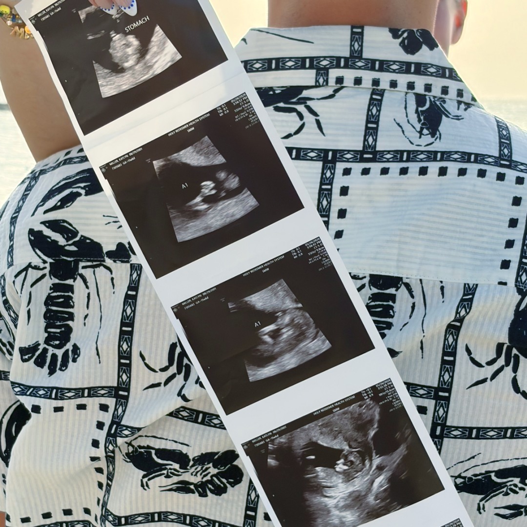 Photo shared by Katie for their Babylist baby registry.