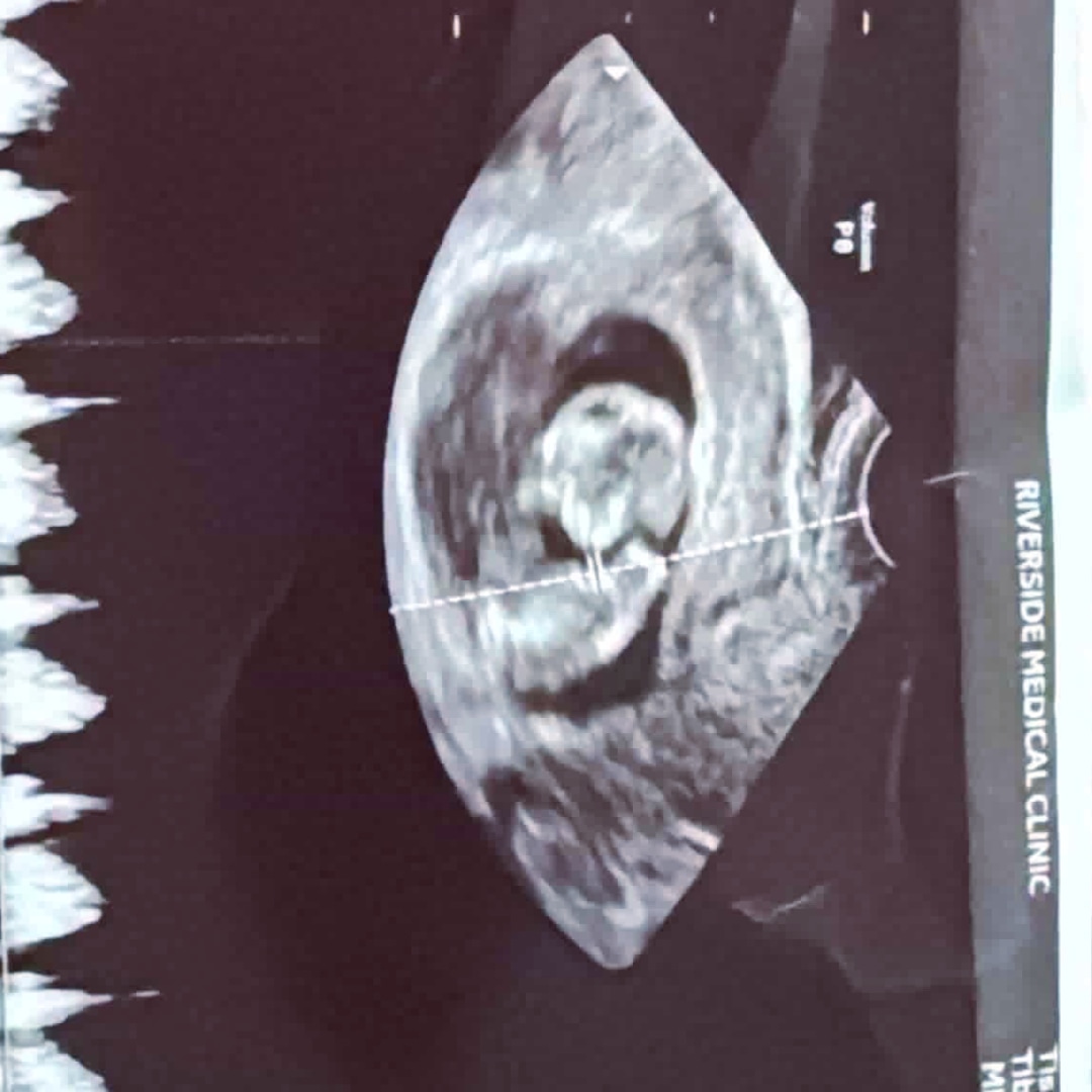 Photo shared by Edith for their Babylist baby registry.