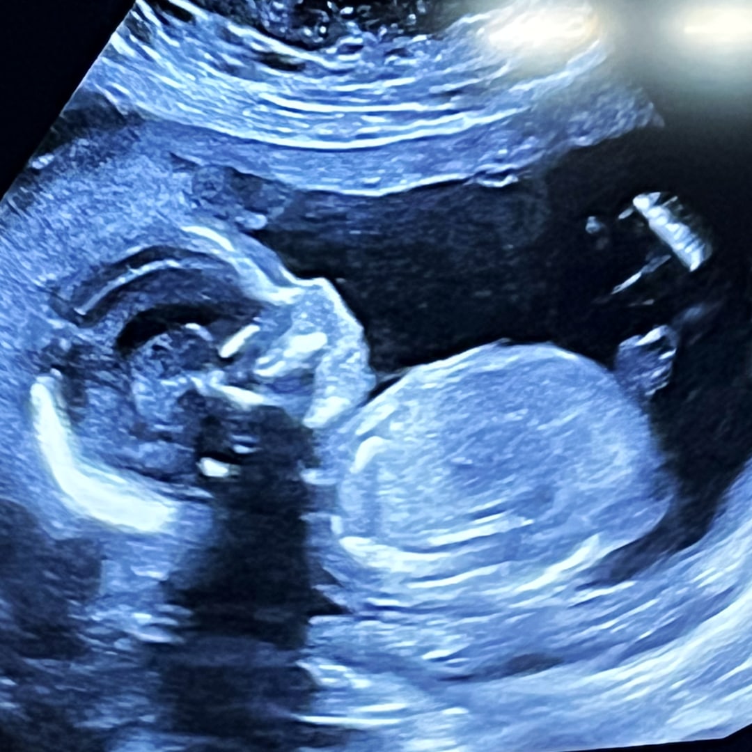 Photo shared by Carly for their Babylist baby registry.