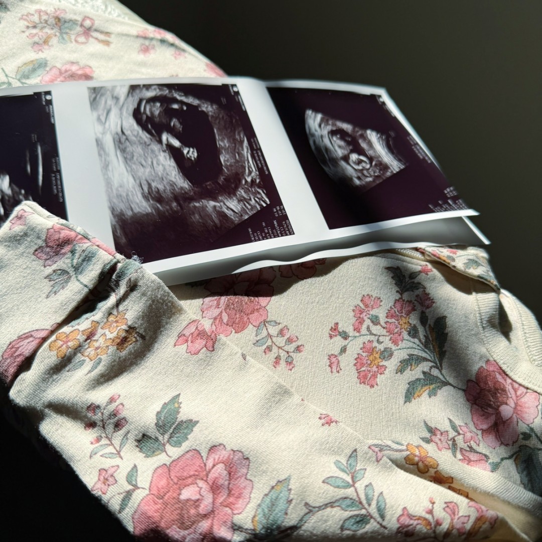 Photo shared by Cindy for their Babylist baby registry.