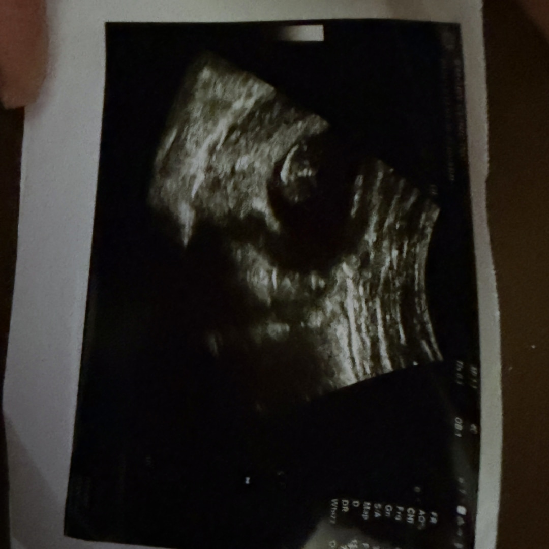 Photo shared by Ayonna for their Babylist baby registry.