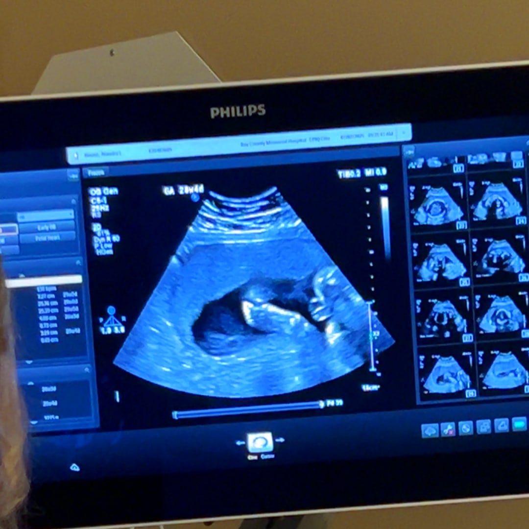 Photo shared by Alandra for their Babylist baby registry.