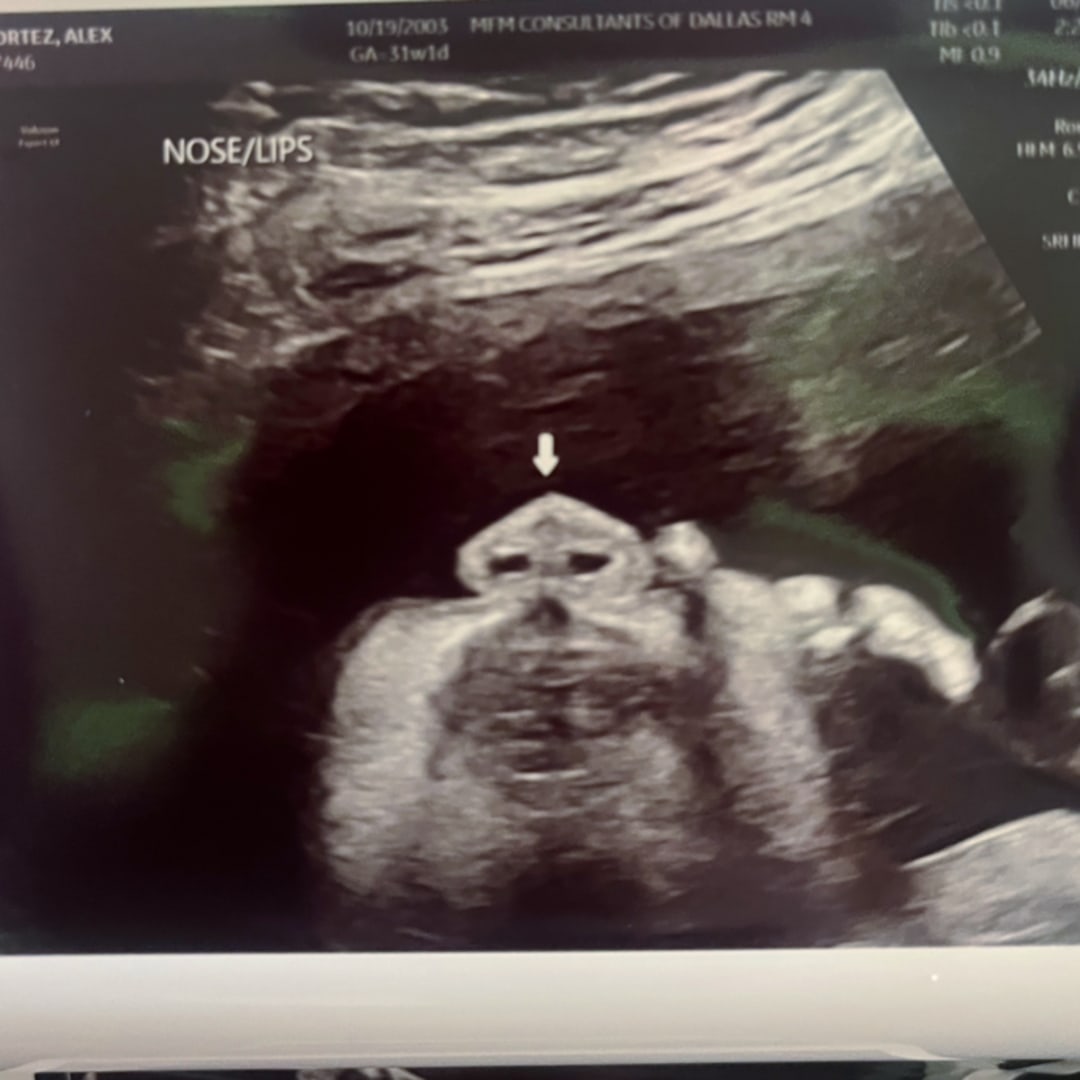 Photo shared by Alex for their Babylist baby registry.