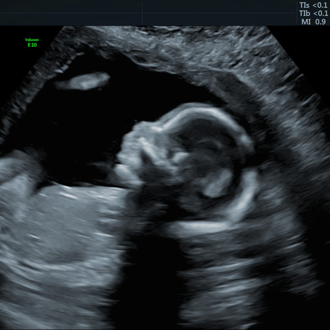 Photo shared by Bre for their Babylist baby registry.