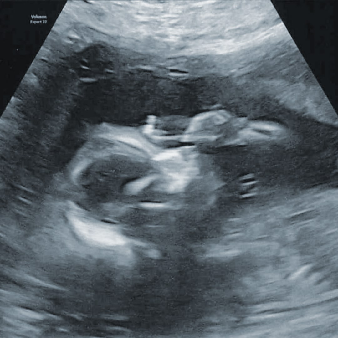 Photo shared by Kaitlyn for their Babylist baby registry.