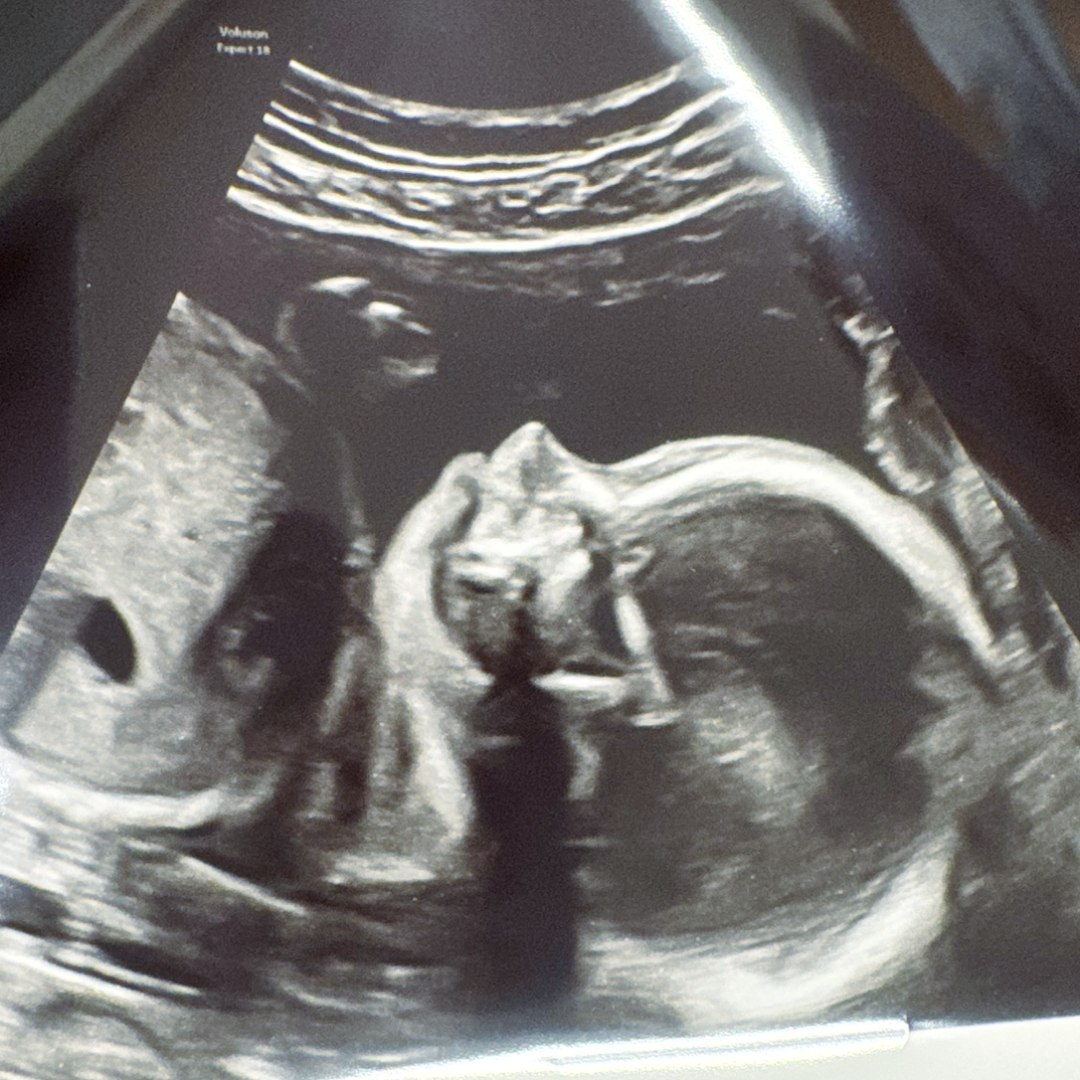 Photo shared by Erynn for their Babylist baby registry.