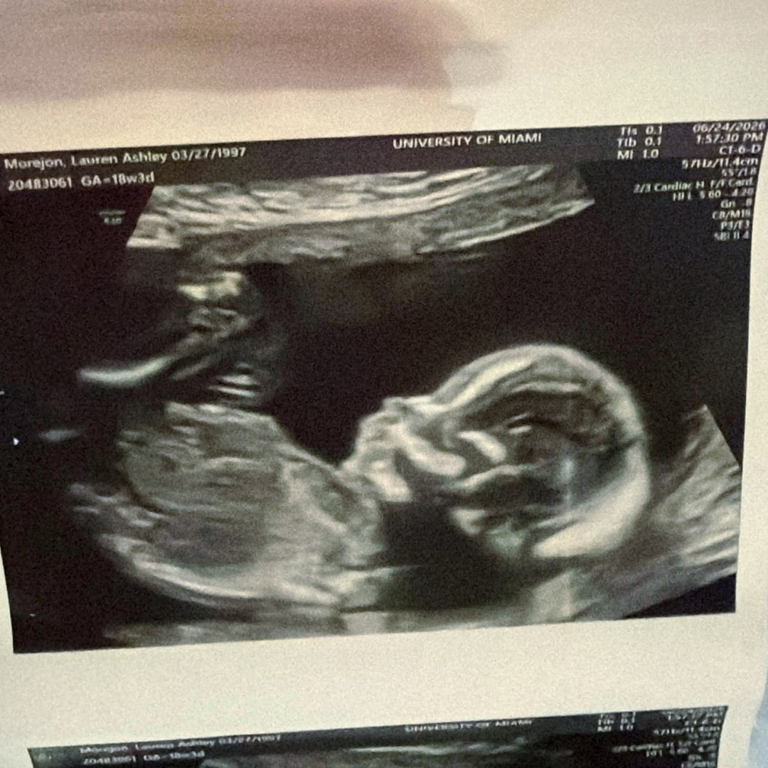 Photo shared by Lauren for their Babylist baby registry.