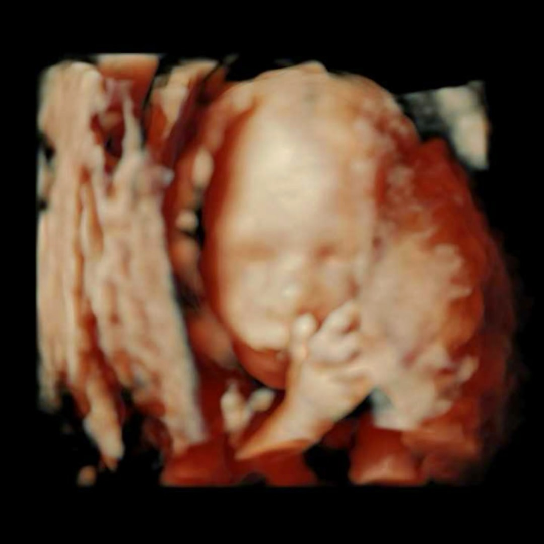 Photo shared by Amanda for their Babylist baby registry.