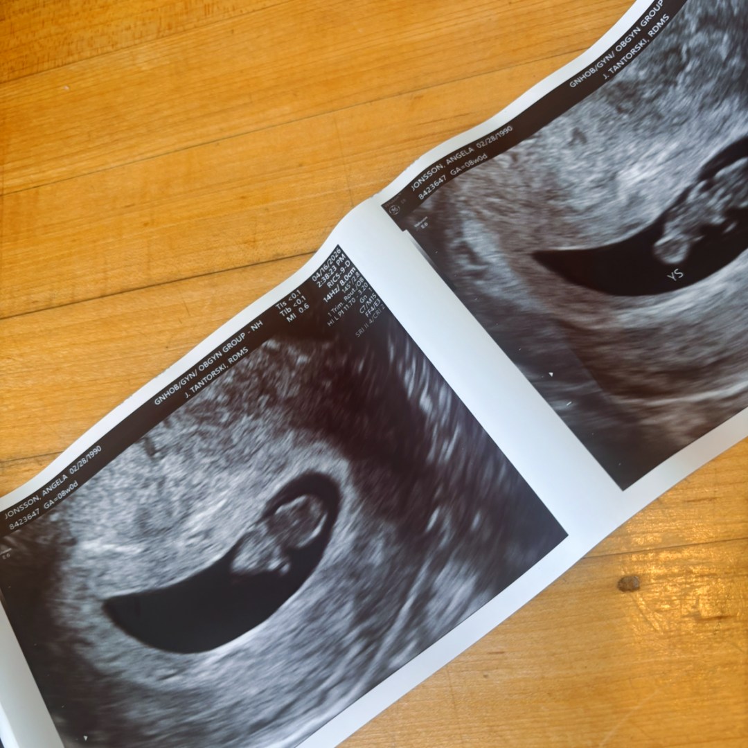 Photo shared by Angela for their Babylist baby registry.