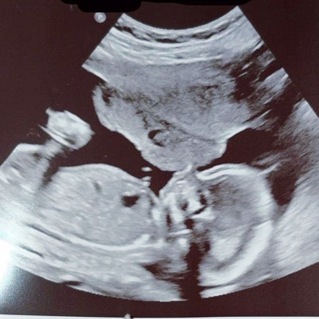 Photo shared by Zoe for their Babylist baby registry.