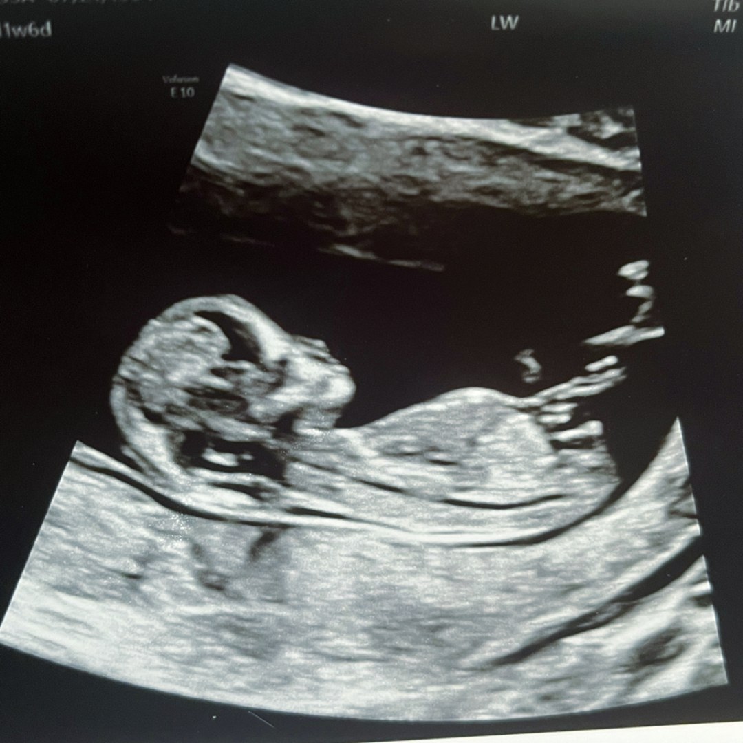 Photo shared by Melissa for their Babylist baby registry.