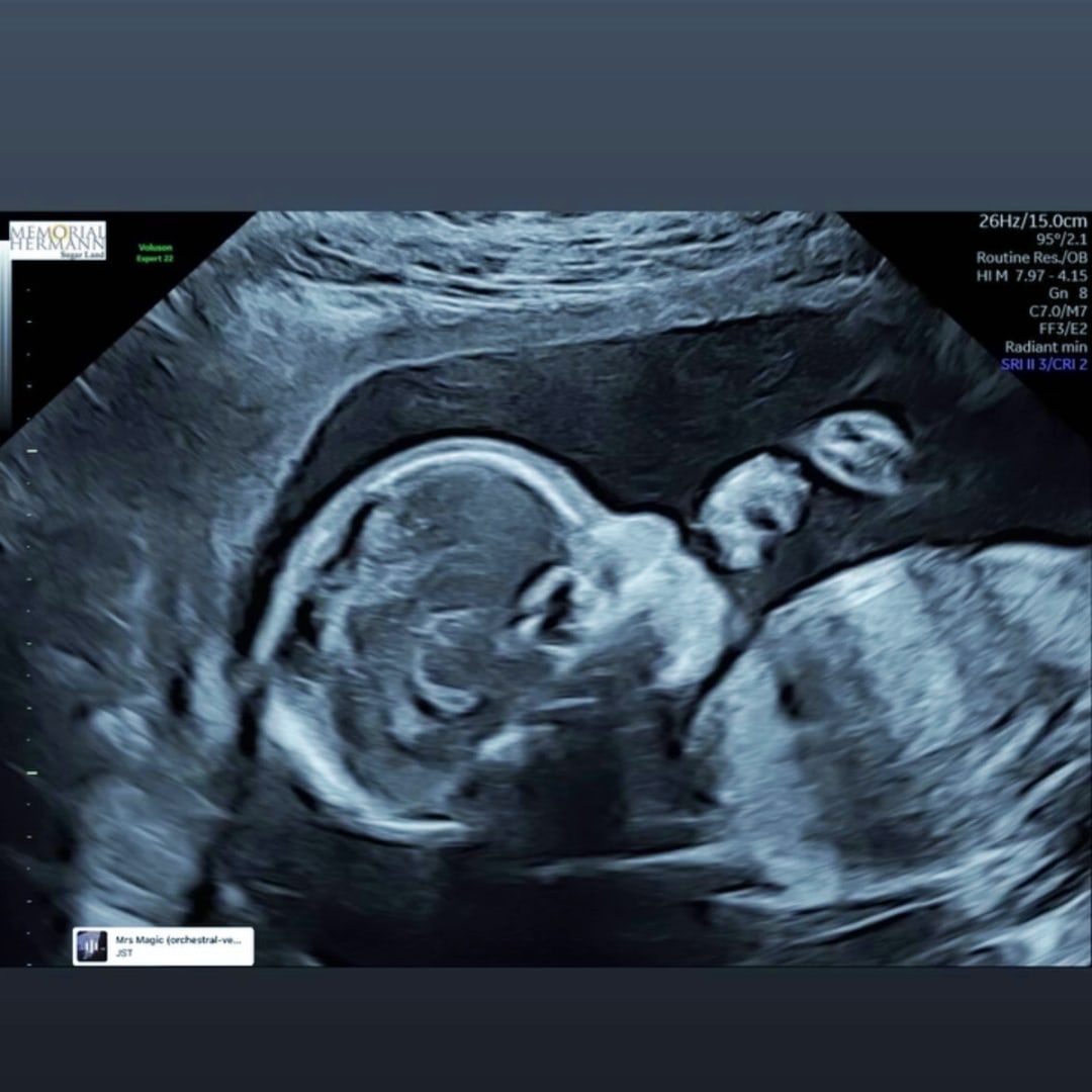 Photo shared by Darlene for their Babylist baby registry.