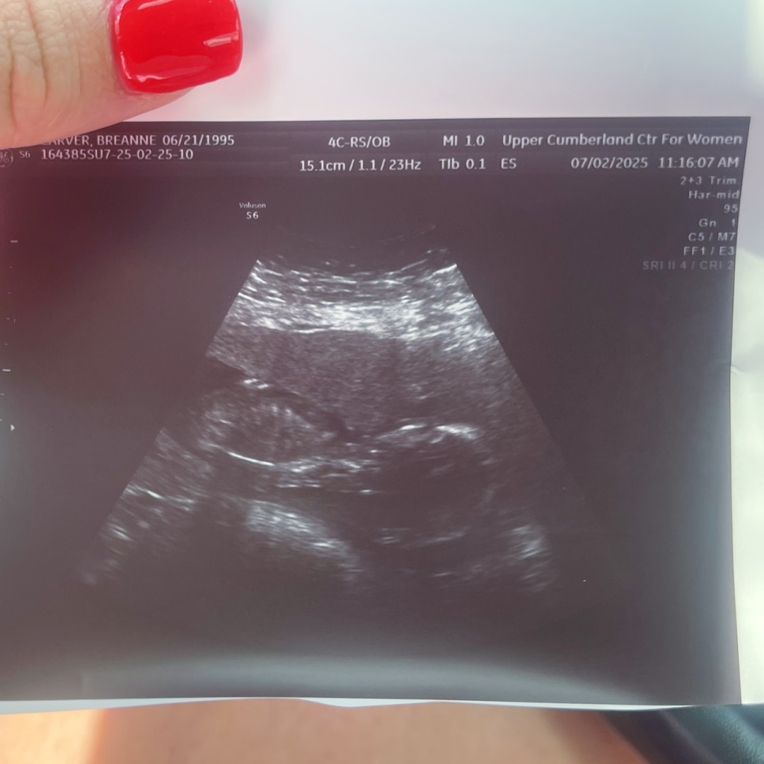 Photo shared by Breanne for their Babylist baby registry.