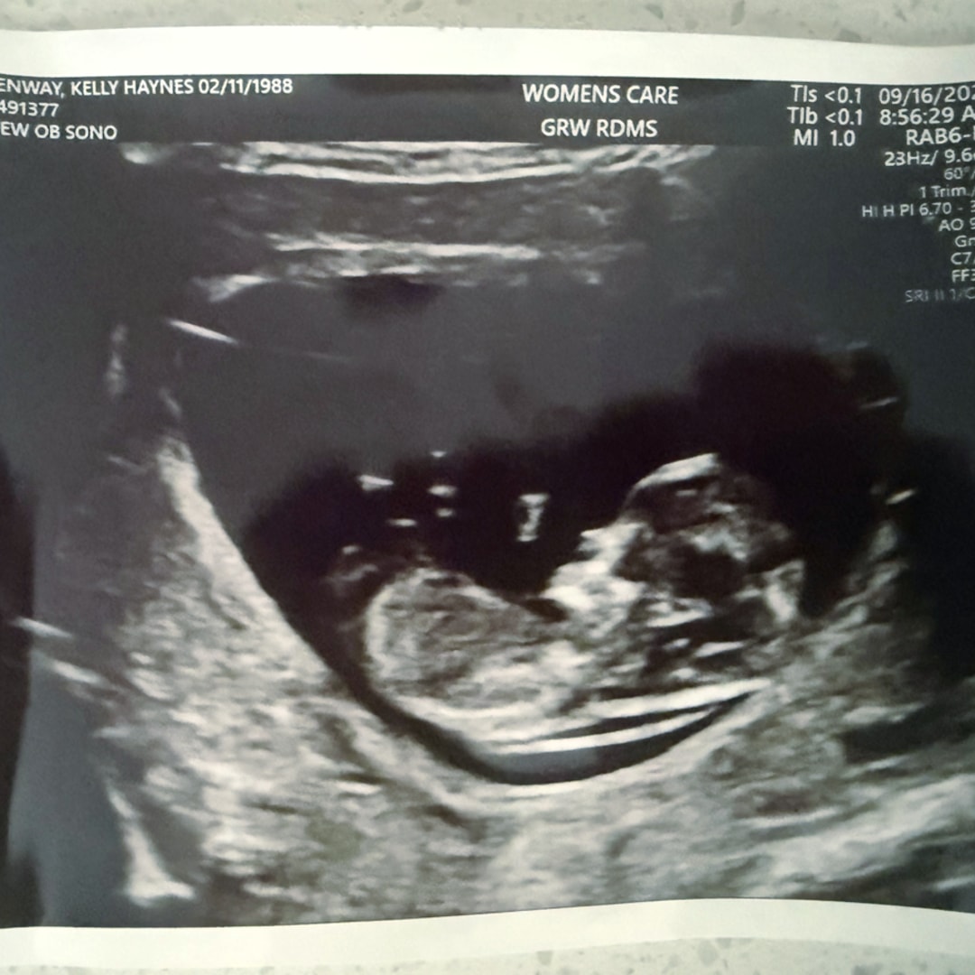 Photo shared by Kelly for their Babylist baby registry.